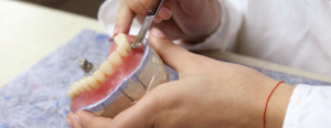 denture repair Melbourne