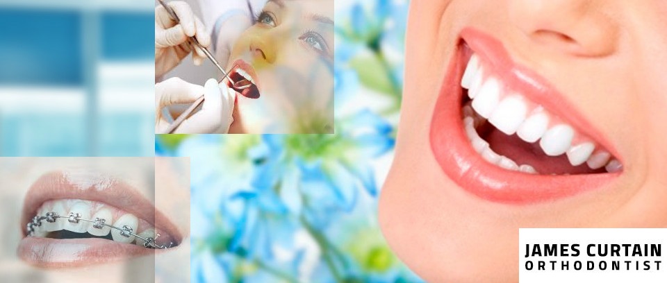 Orthodontist Melbourne