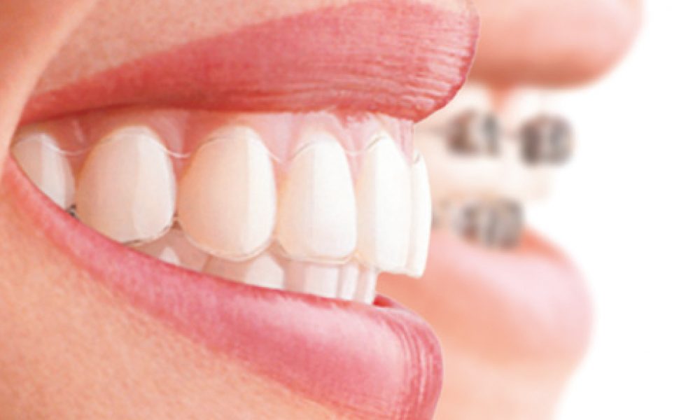 Selecting the best orthodontists? Here are some guidelines