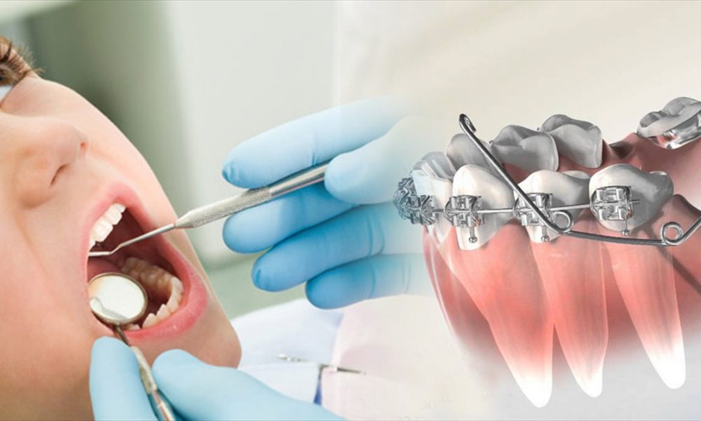 Best Orthodontist Melbourne