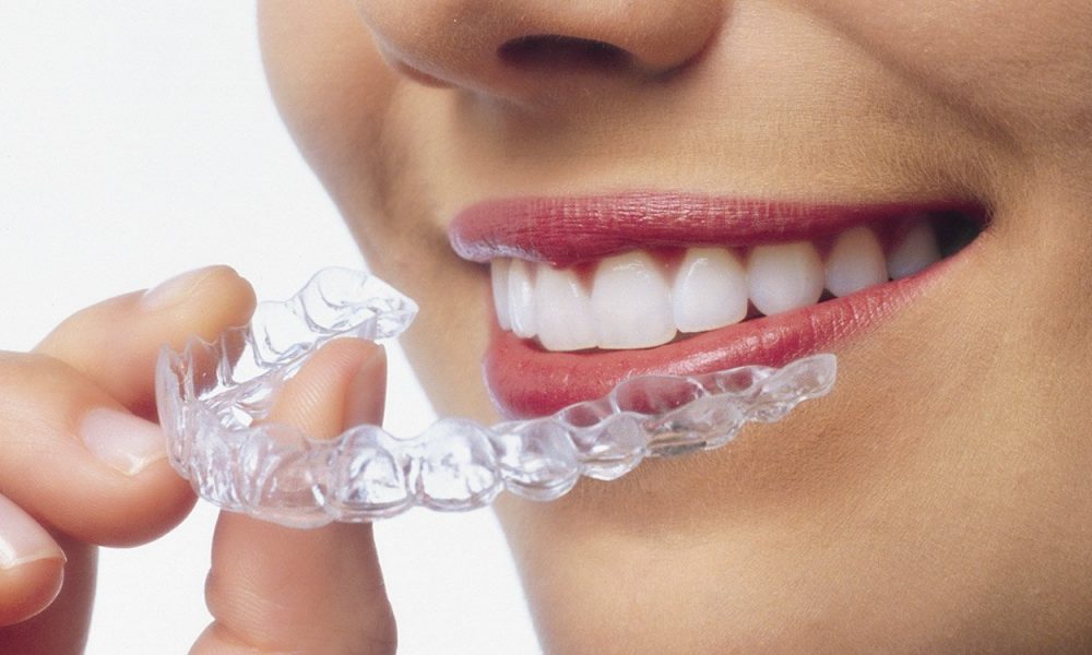 Health Awareness: Few Things to Know About Mouthguards