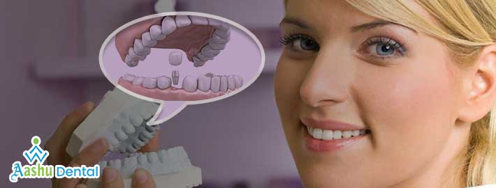 What Are The Benefits Of The Cosmetic Dentistry In Ahmedabad?