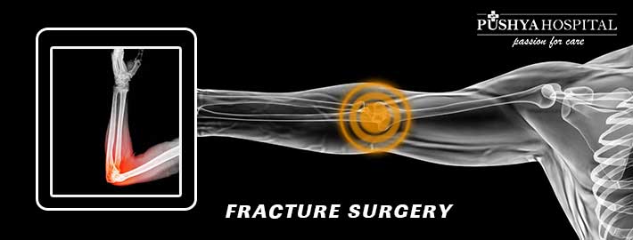 Fracture Surgery In Ahmedabad